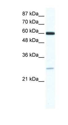 Western Blot: ZFP91 Antibody [NBP1-80136]