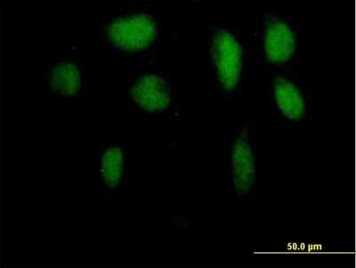 Immunocytochemistry/ Immunofluorescence: ZFP95 Antibody [H00023660-B01P]