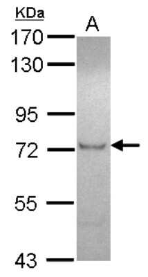 Western Blot: ZFP95 Antibody [NBP2-20947]