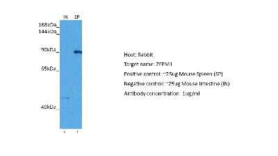Western Blot: ZFPM1 Antibody [NBP2-88621]