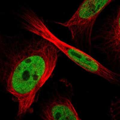 Immunocytochemistry/ Immunofluorescence: ZFR Antibody [NBP1-80601]