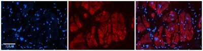 Immunohistochemistry: ZFR Antibody [NBP1-82402]
