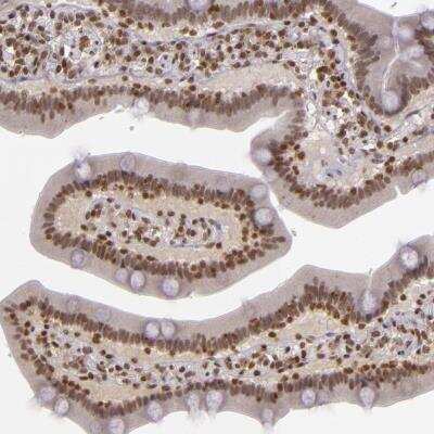 Immunohistochemistry-Paraffin: ZFX Antibody [NBP1-80583]