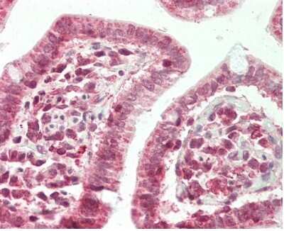 Immunohistochemistry-Paraffin: ZFX Antibody [NBP2-86421]