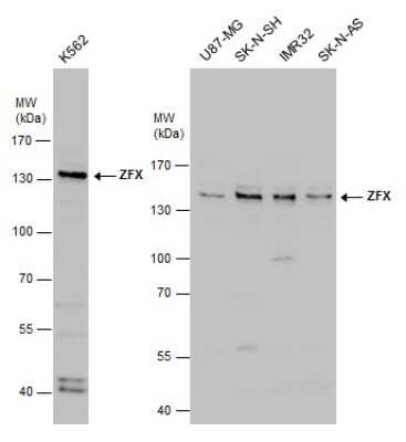 Western Blot: ZFX Antibody [NBP3-12949]