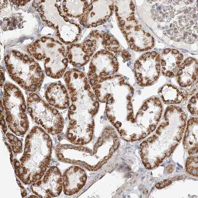 Immunohistochemistry-Paraffin: ZFYVE16 Antibody [NBP1-81516]