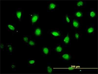 Immunocytochemistry/ Immunofluorescence: ZFYVE19 Antibody (4D5-2D11) [H00084936-M01]