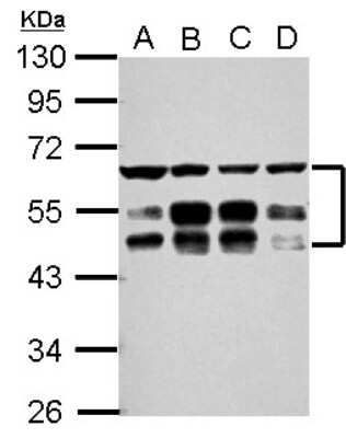 Western Blot: ZFYVE19 Antibody [NBP2-20951]