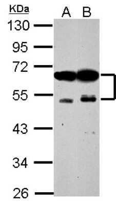 Western Blot: ZFYVE19 Antibody [NBP2-20951]