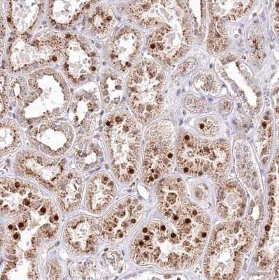 Immunohistochemistry-Paraffin: ZFYVE27 Antibody [NBP1-83512]