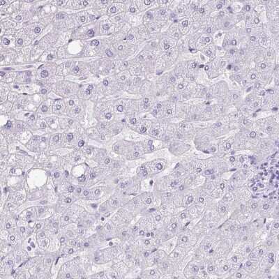 Immunohistochemistry-Paraffin: ZG16 Antibody [NBP2-30488]