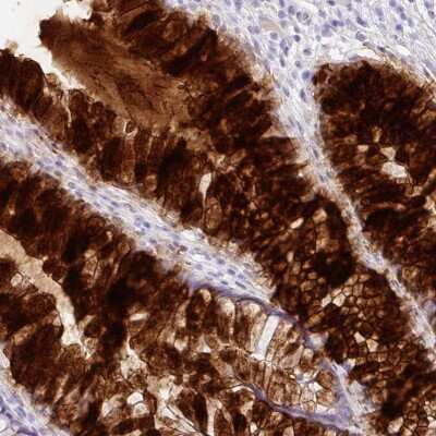 Immunohistochemistry-Paraffin: ZG16 Antibody [NBP2-30488]