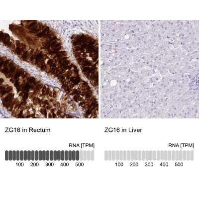 Immunohistochemistry-Paraffin: ZG16 Antibody [NBP2-30488]