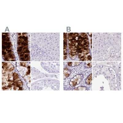 Immunohistochemistry-Paraffin: ZG16 Antibody [NBP2-30488]