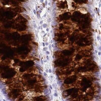 Immunohistochemistry-Paraffin: ZG16 Antibody [NBP2-30488]