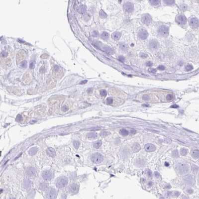 Immunohistochemistry-Paraffin: ZG16 Antibody [NBP2-30488]