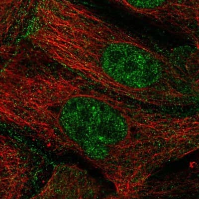 Immunocytochemistry/ Immunofluorescence: ZGPAT Antibody [NBP2-55609]