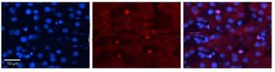 Immunohistochemistry-Paraffin: ZGPAT Antibody [NBP1-56561]