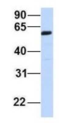 Western Blot: ZGPAT Antibody [NBP1-56937]