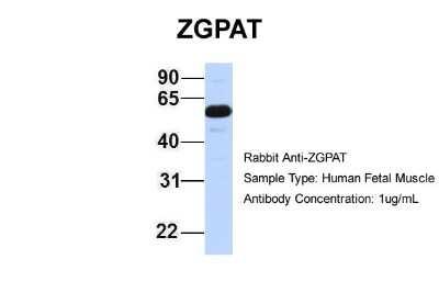 Western Blot: ZGPAT Antibody [NBP1-56937]
