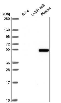 Western Blot: ZGPAT Antibody [NBP2-55609]
