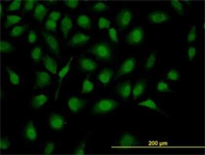 Immunocytochemistry/ Immunofluorescence: ZHX2 Antibody (5E2) [H00022882-M01]