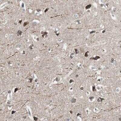 Immunohistochemistry-Paraffin: ZHX2 Antibody [NBP1-82955]