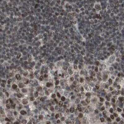 Immunohistochemistry-Paraffin: ZHX2 Antibody [NBP1-82956]
