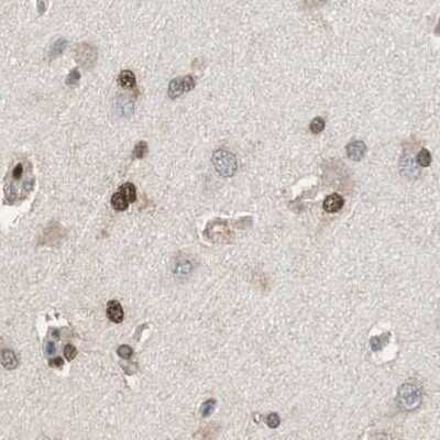 Immunohistochemistry-Paraffin: ZHX2 Antibody [NBP1-82956]