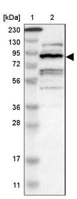 Western Blot: ZHX2 Antibody [NBP1-82956]