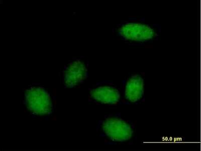 Immunocytochemistry/ Immunofluorescence: ZHX3 Antibody [H00023051-B01P]