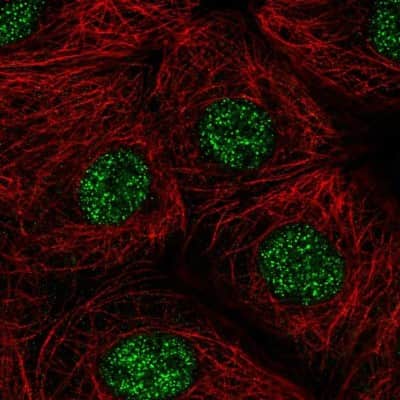 Immunocytochemistry/ Immunofluorescence: ZIC1 Antibody [NBP1-86833]