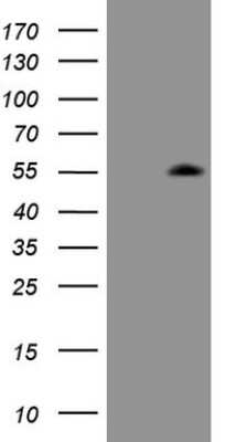Western Blot: ZIC3 Antibody (OTI1G7) [NBP2-46414]