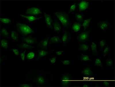 Immunocytochemistry/ Immunofluorescence: ZIC4 Antibody (2C2) [H00084107-M07]