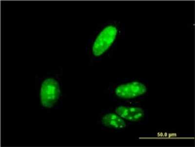 Immunocytochemistry/ Immunofluorescence: ZIC4 Antibody (3A2) [H00084107-M09]