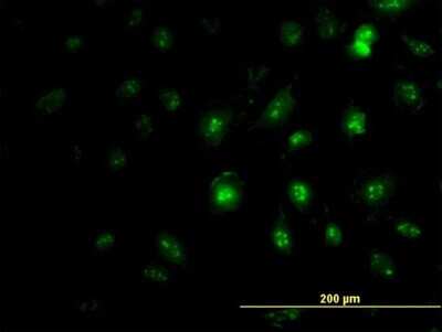 Immunocytochemistry/ Immunofluorescence: ZIC4 Antibody (3D5) [H00084107-M06]