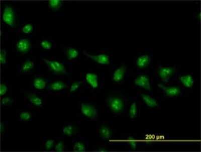 Immunocytochemistry/ Immunofluorescence: ZIC4 Antibody (4B1) [H00084107-M01]