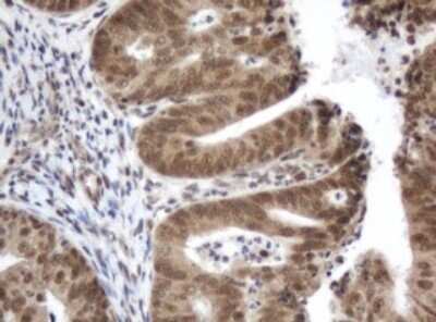 Immunohistochemistry: ZIM2 Antibody (OTI6D12) [NBP2-46415]