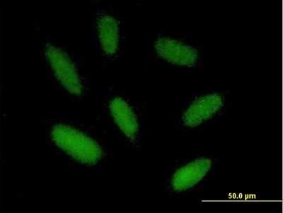 Immunocytochemistry/ Immunofluorescence: ZIM2 Antibody [H00023619-B01P]