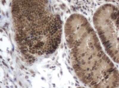 Immunohistochemistry: ZIM2 Antibody (OTI6D12) - Azide and BSA Free [NBP2-74928]