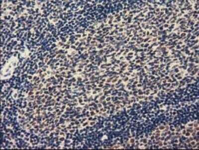 Immunohistochemistry-Paraffin: ZIM2 Antibody (OTI7G1) [NBP2-03325]