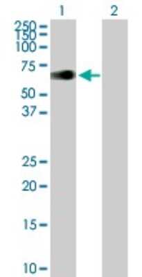 Western Blot: ZIM2 Antibody [H00023619-B01P]
