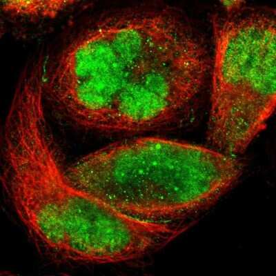 Immunocytochemistry/ Immunofluorescence: ZKSCAN1 Antibody [NBP1-81346]