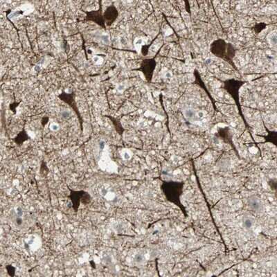 Immunohistochemistry-Paraffin: ZKSCAN1 Antibody [NBP1-81346]