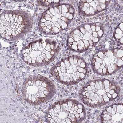 Immunohistochemistry-Paraffin: ZKSCAN2 Antibody [NBP2-13549]