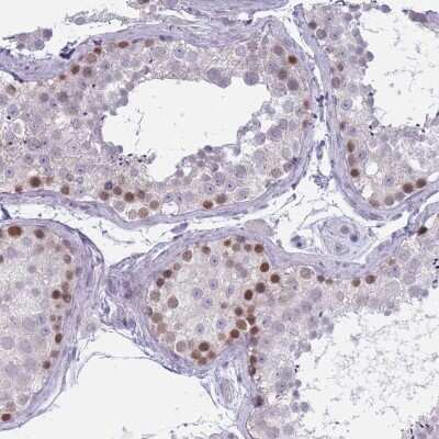 Immunohistochemistry-Paraffin: ZKSCAN2 Antibody [NBP2-13549]