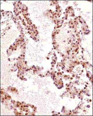Immunohistochemistry-Paraffin: ZKSCAN3 Antibody - BSA Free [NBP1-31566]