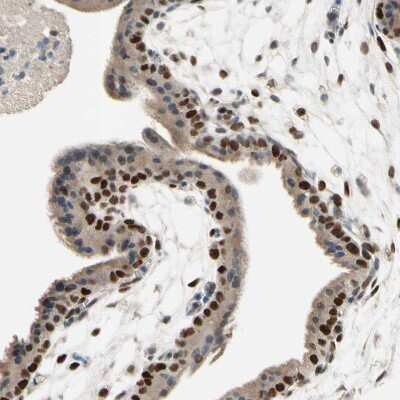 Immunohistochemistry-Paraffin: ZKSCAN3 Antibody [NBP2-47570]