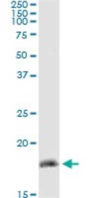 Immunoprecipitation: ZMAT4 Antibody (2A4) [H00079698-M02]