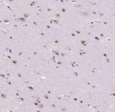 Immunohistochemistry-Paraffin: ZMAT4 Antibody [NBP2-49619]